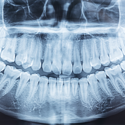 Associates in Dentistry | Implant Restorations, TMJ Disorders and Emergency Treatment