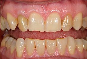 Associates in Dentistry | Teeth Whitening, Dental Bridges and Reveal reg Clear Aligners