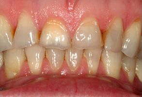 Associates in Dentistry | Reveal reg Clear Aligners, Emergency Treatment and Aesthetic Tooth Colored Fillings