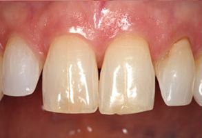Associates in Dentistry | Teeth Whitening, Reveal reg Clear Aligners and Emergency Treatment